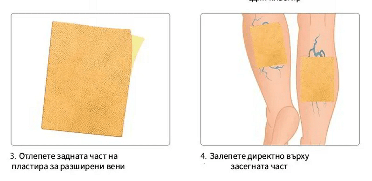 24бр. Билкови Пластири за облекчаване на разширени вени