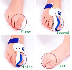 Goodnight Bunion Нощна шина ортеза при изпъкнали кокалчета на палеца на крака чифт