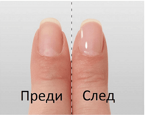 Комплект за полиране и оформяне на нокти, JOYCARE