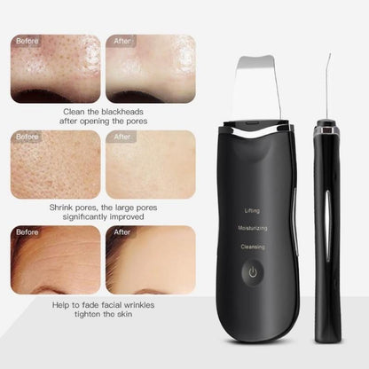 ULTRASONIC SKIN CLEANER,УЛТРАЗВУКОВА ШПАТУЛА ЗА ПОЧИСТВАНЕ НА ЛИЦЕ